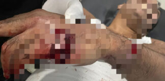 Polisi Selidiki Dugaan Penganiayaan di Ternate Selatan